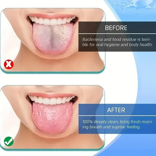 Raspador de Lengua de Acero Inoxidable en 4 Colores | Limpiador Bucal en Forma de U para Aliento Fresco e Higiene Oral