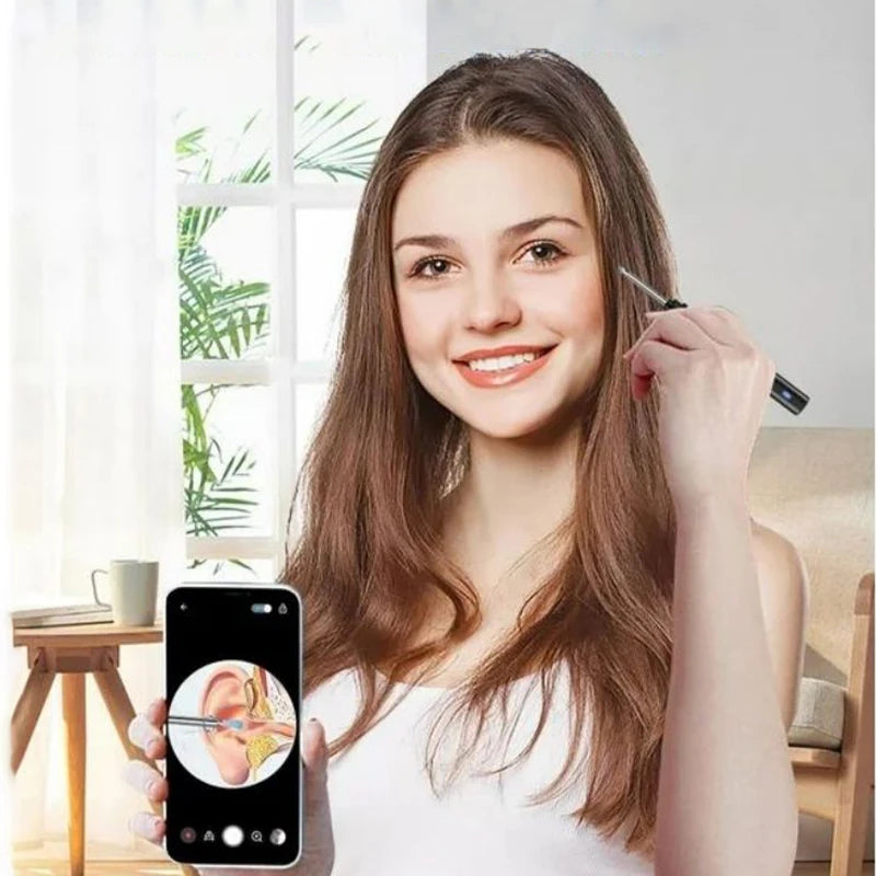 Limpiador de Oídos con Cámara HD 5MP y Luz LED | Kit Inteligente de Limpieza Auricular Inalámbrico USB Recargable