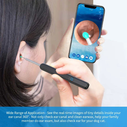 Limpiador de Oídos con Cámara HD 5MP y Luz LED | Kit Inteligente de Limpieza Auricular Inalámbrico USB Recargable